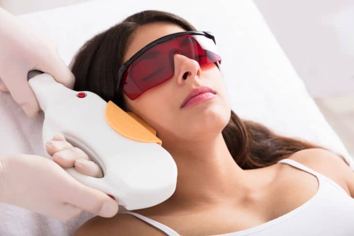 laser skin treatment