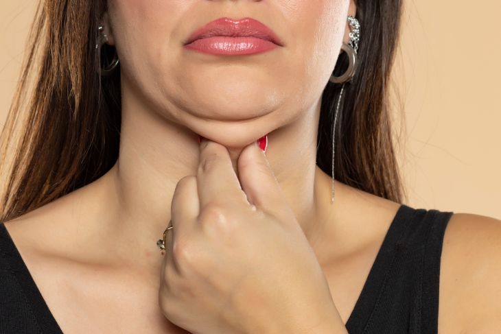 reduce double chin